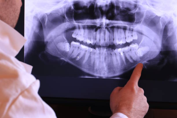 Best Emergency Treatment for Dental Infections or Abscesses in Monroe, LA
