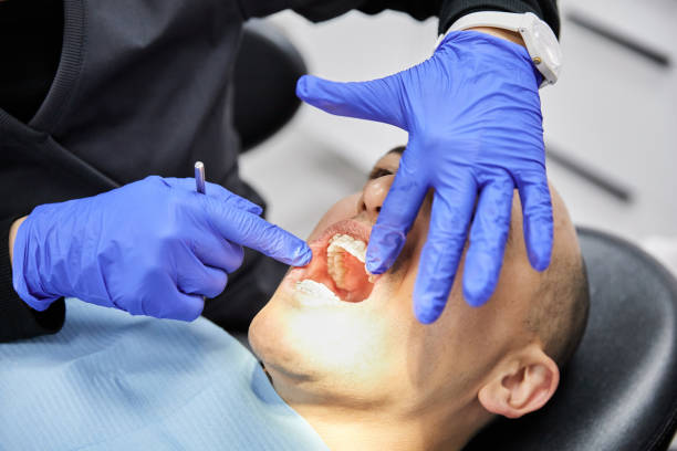 Best Emergency Dental Care for Broken or Chipped Teeth in Monroe, LA